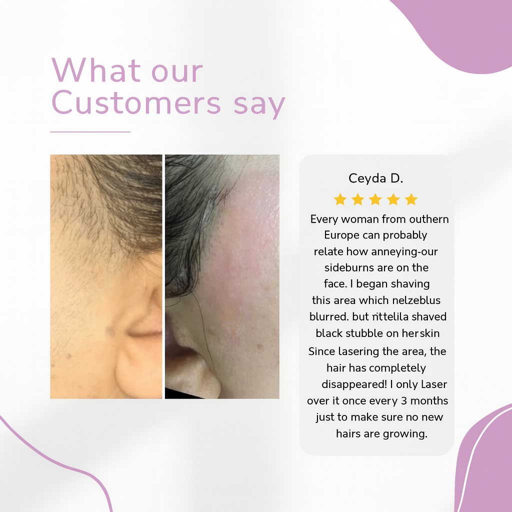 IPL Hair Remover – Smooth, Hair-Free Skin From Home