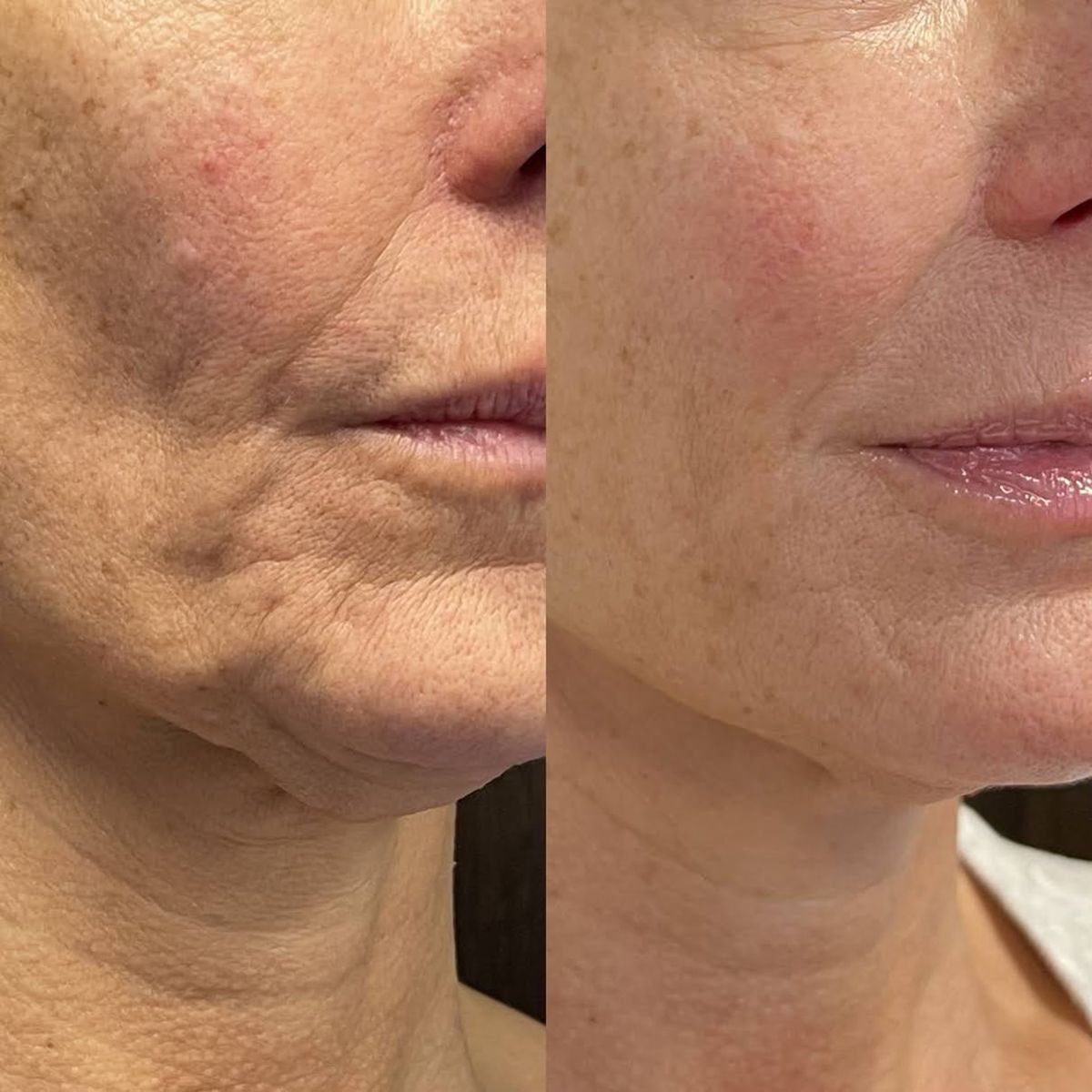 Nectaré Anti-Aging Serum Stick