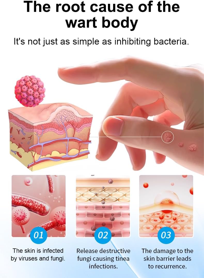 DermaTag Removal Kit