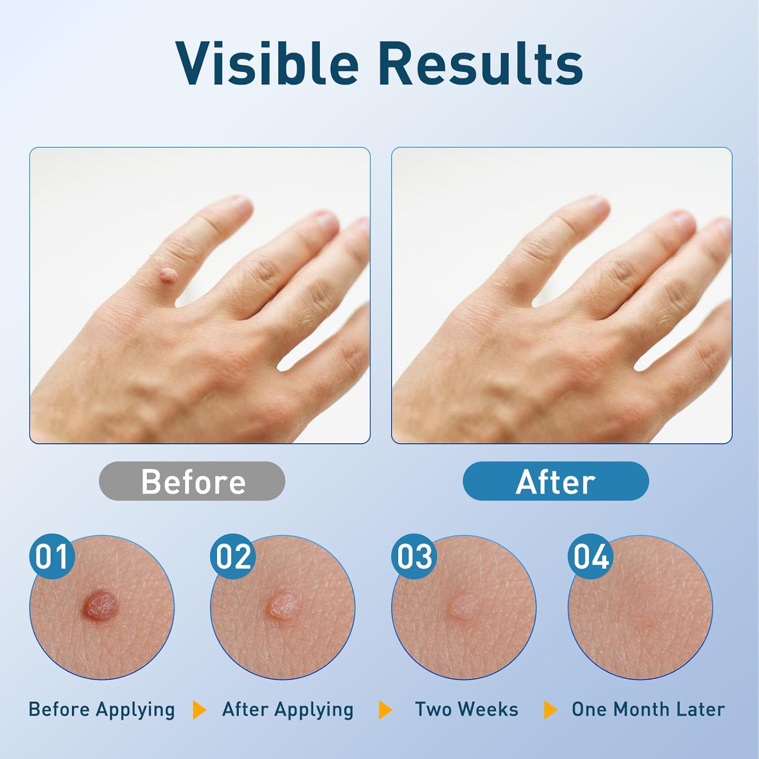 DermaTag Removal Kit