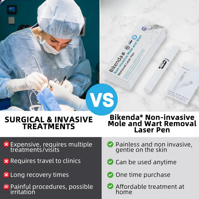 Molde® Promax Laser Pen – Non-Invasive Mole & Wart Removal