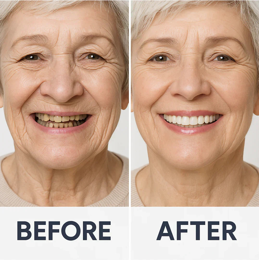 Comfort-Fit Flexible Dentures – Natural Look Easy Wear & Removal