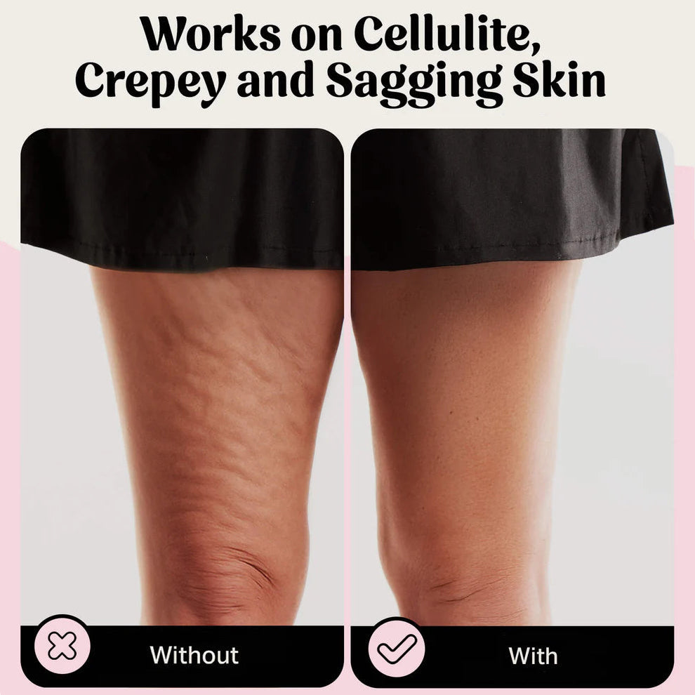 Élevare™ Skin Tape