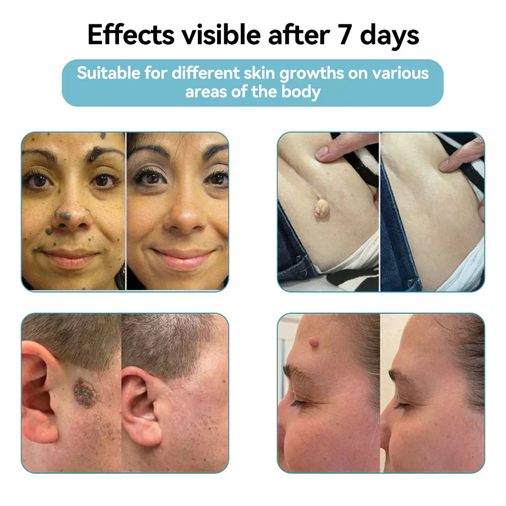 DermaBeam Pro – Erase Skin Flaws Instantly