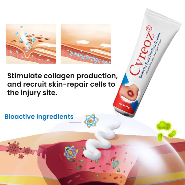 🔥LIMITED SPECIAL OFFER🔥  Cvreoz® Diabetic Foot Healing Cream