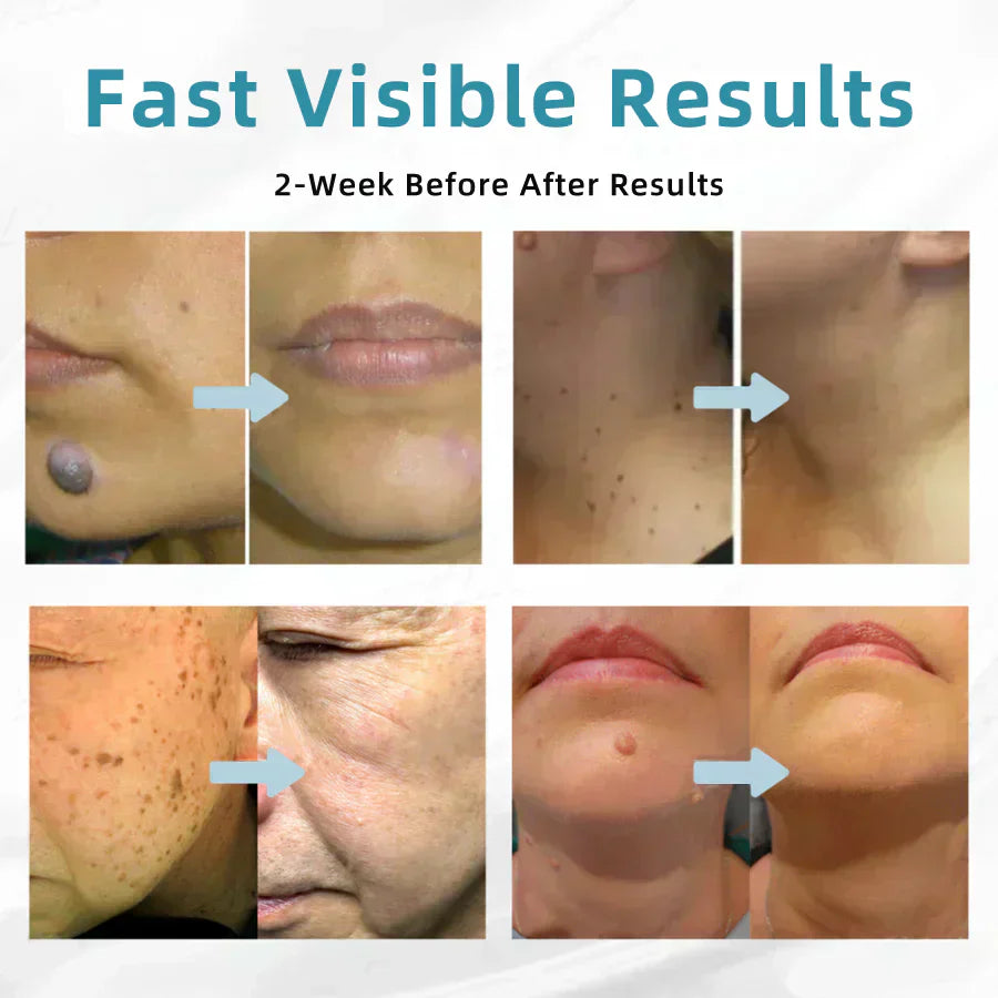 DermaBeam Pro – Erase Skin Flaws Instantly