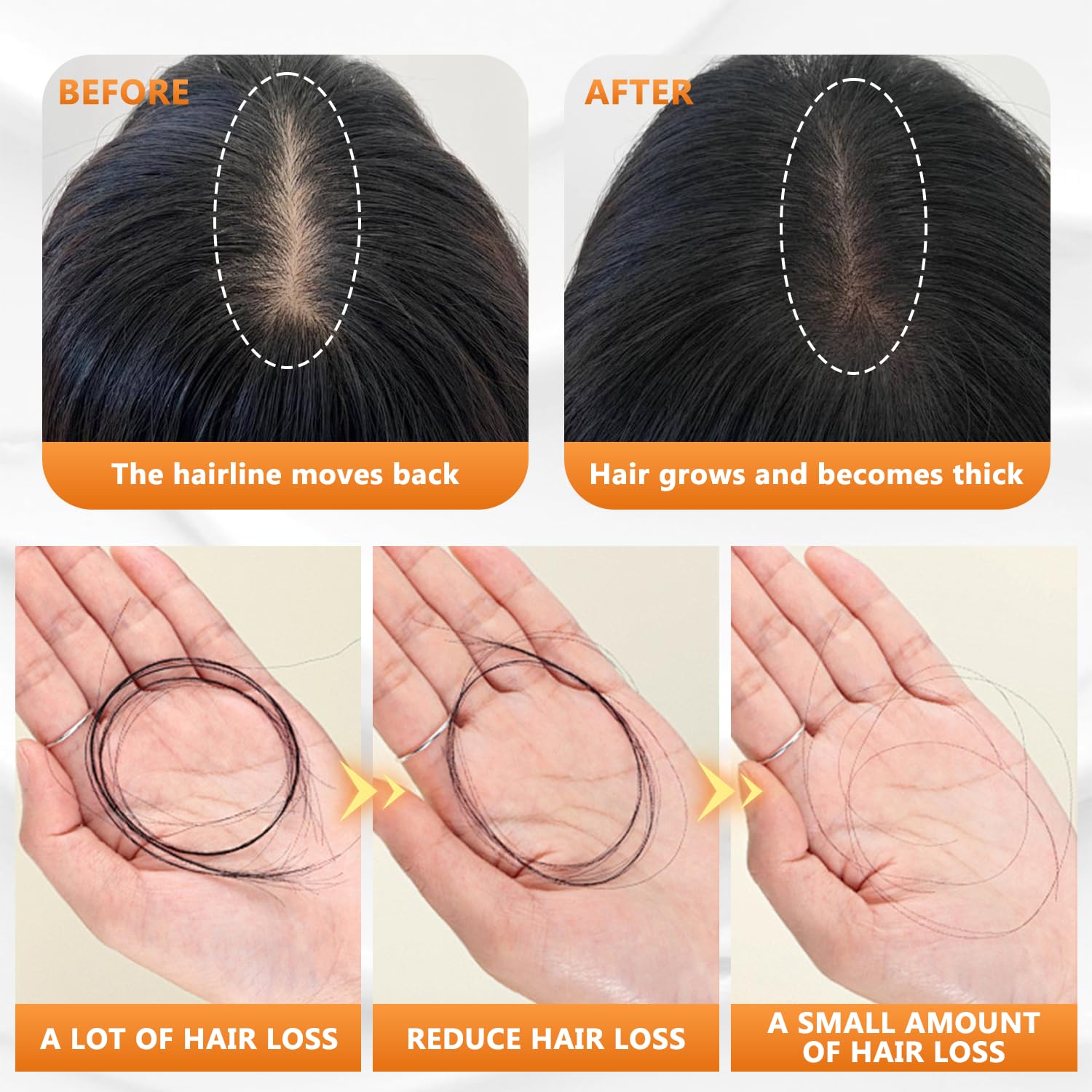 The Root-Strength Shampoo - Thicker Hair, Less Hair Fall
