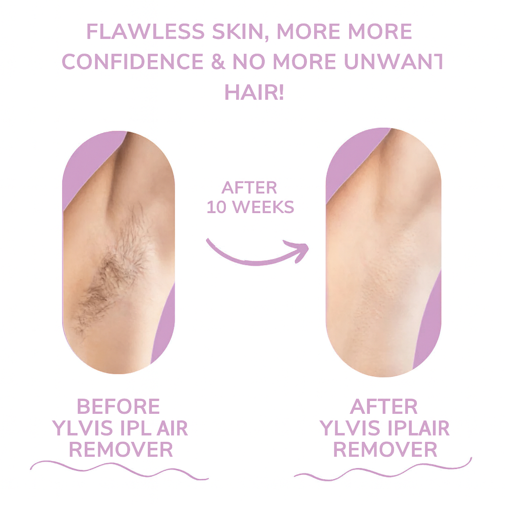IPL Hair Remover – Smooth, Hair-Free Skin From Home