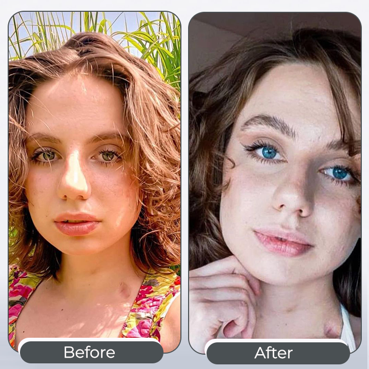 EyeKolor™ Iris Color Change Eye Drops