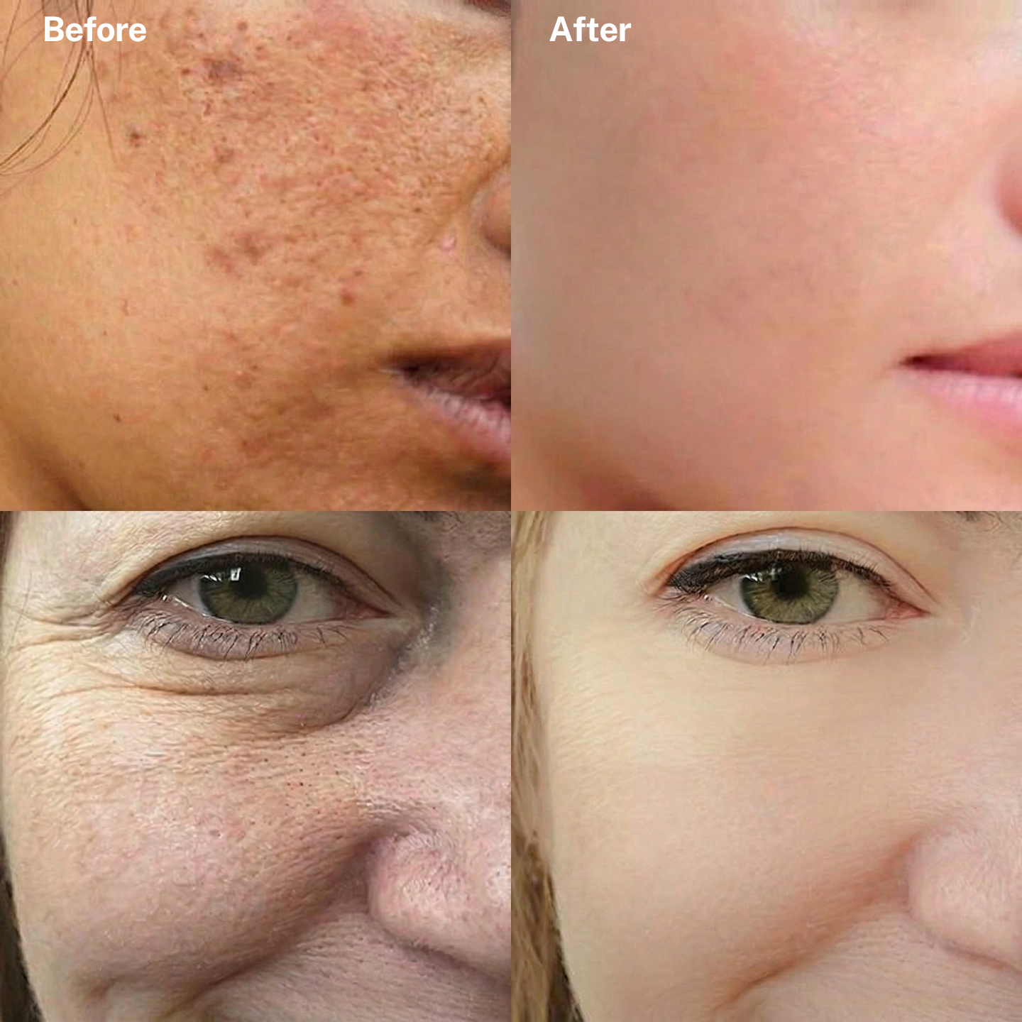 SilkPores™ – K-Beauty's Secret To Glass Skin