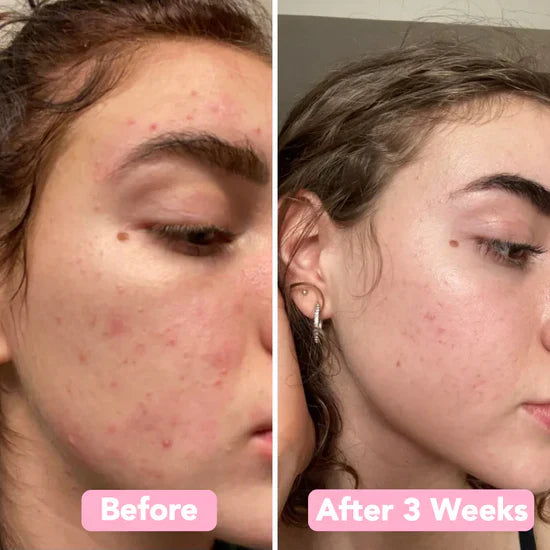 Caedrea Kojic™ Turmeric & Kojic Acid Pads | 40 Pack