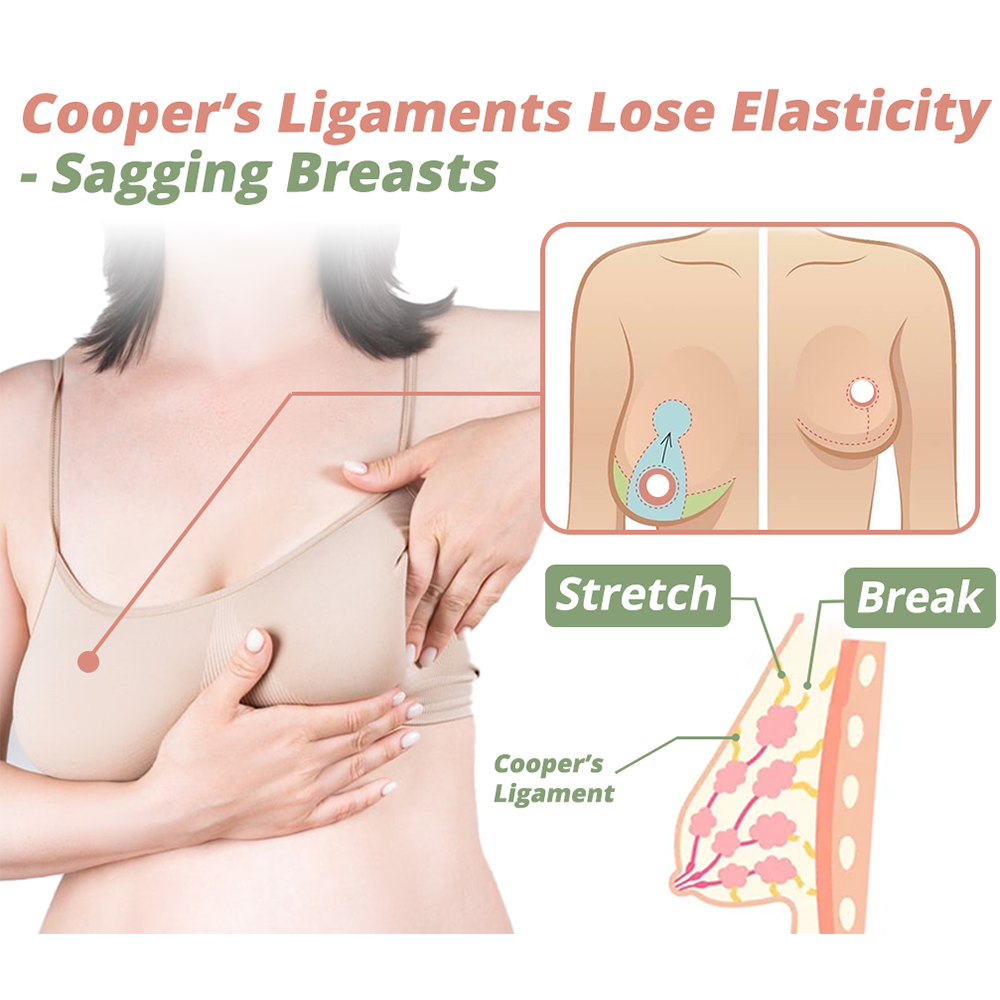 Breast Lift Patch  - Natural Firming Support