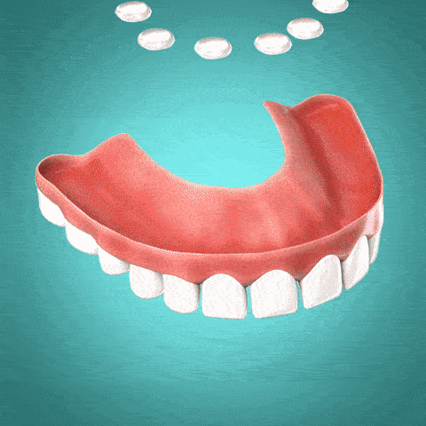 Dental Prosthesis Silicone Set - Custom-Fit Denture Liner
