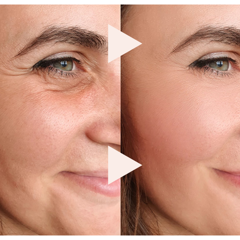 The 10-Second Wrinkle Eraser - An Instant Lift in a Stick