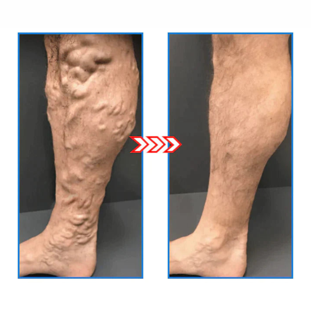 FormSocks™ - Compression socks with tourmaline-ion technology (3 Pairs)