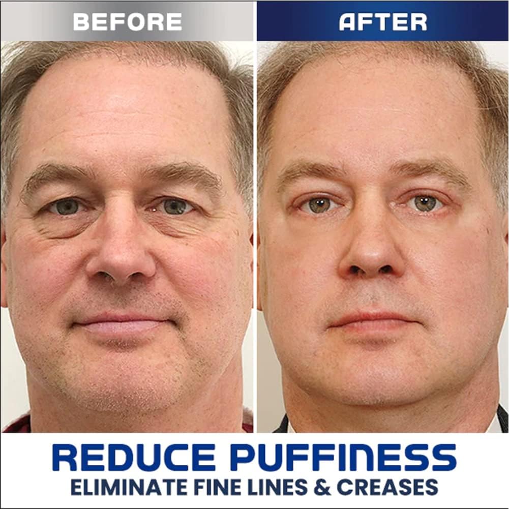 Eye Lifting Gel - Peptide Formula Firming Effect