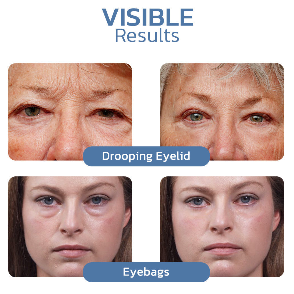 Eye Lifting Gel - Peptide Formula Firming Effect