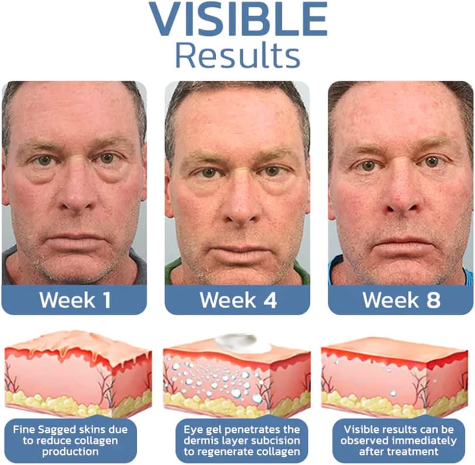 Eye Lifting Gel - Peptide Formula Firming Effect