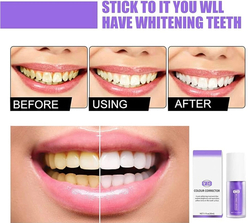 1+1 FREE I SmileKit™ | Feel more confident with a fresh, radiant smile that lasts
