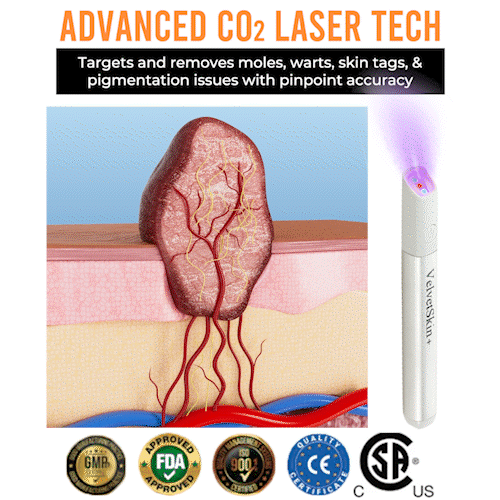 DermaBeam Pro – Erase Skin Flaws Instantly