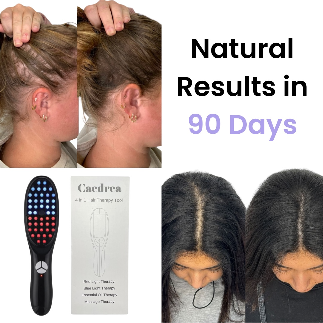 CaedreaBrush™ - 4in1 natural hair growth brush