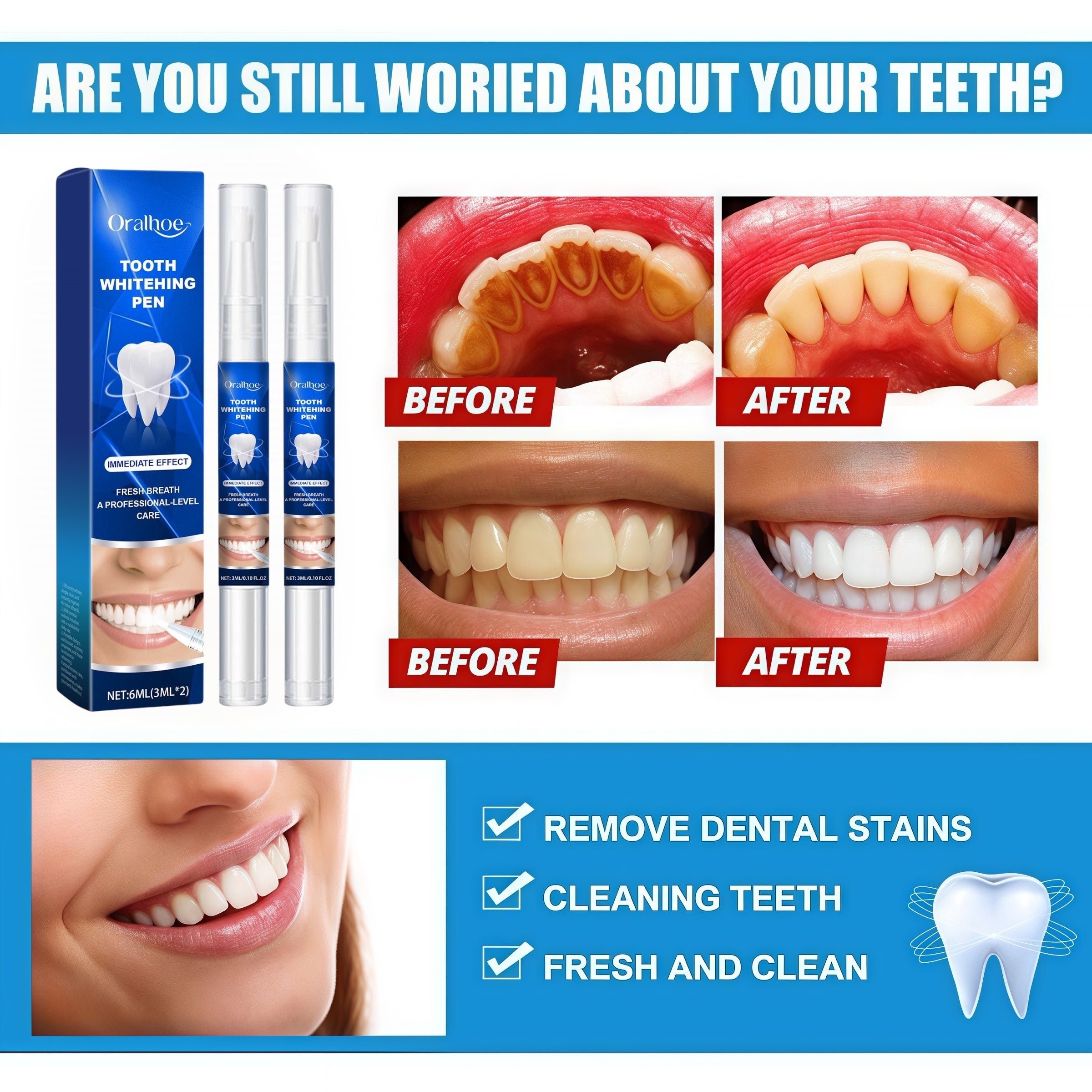 1+1 FREE l OralPlus™ Brighten your smile effortlessly