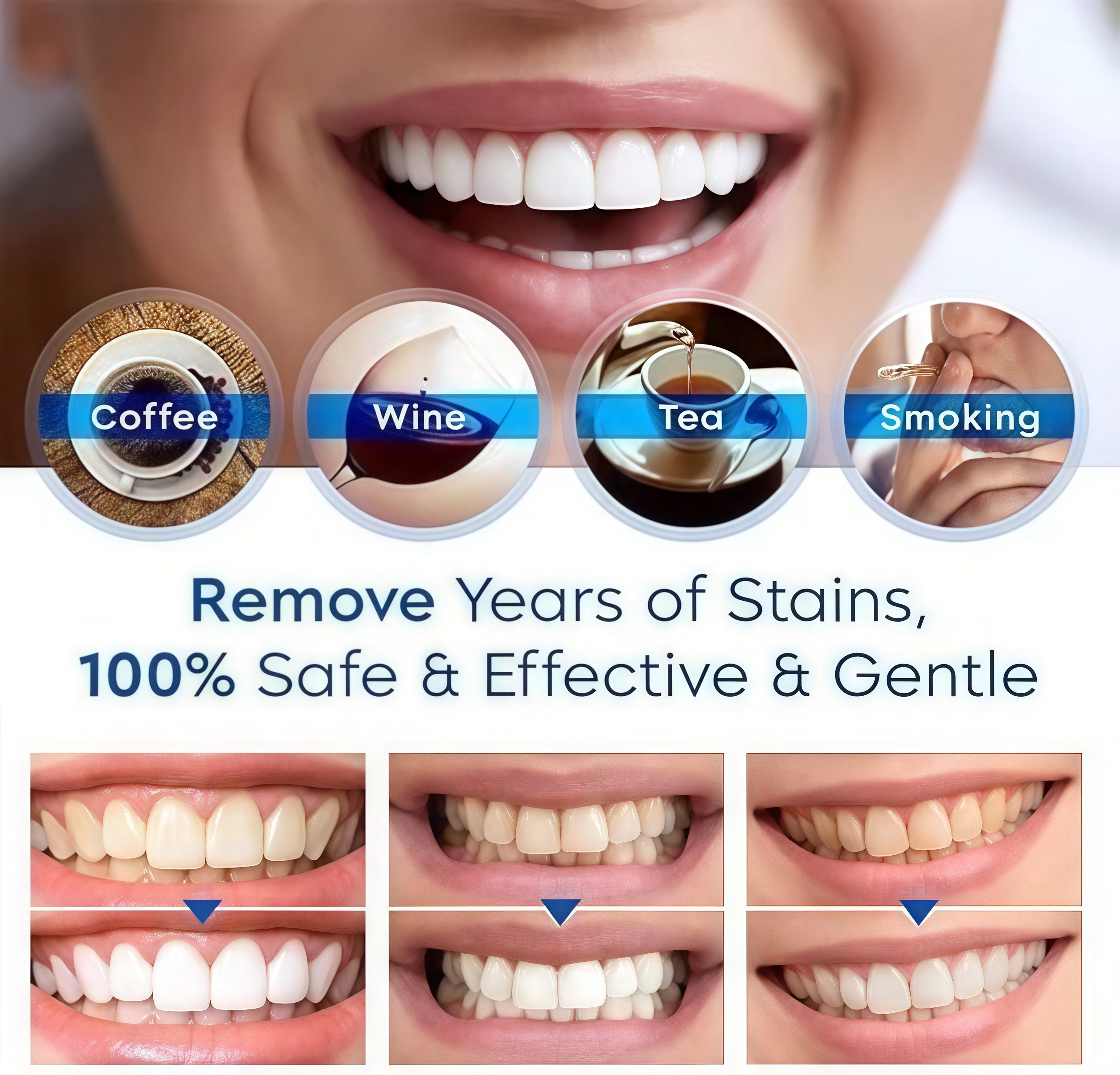 1+1 FREE l OralPlus™ Brighten your smile effortlessly