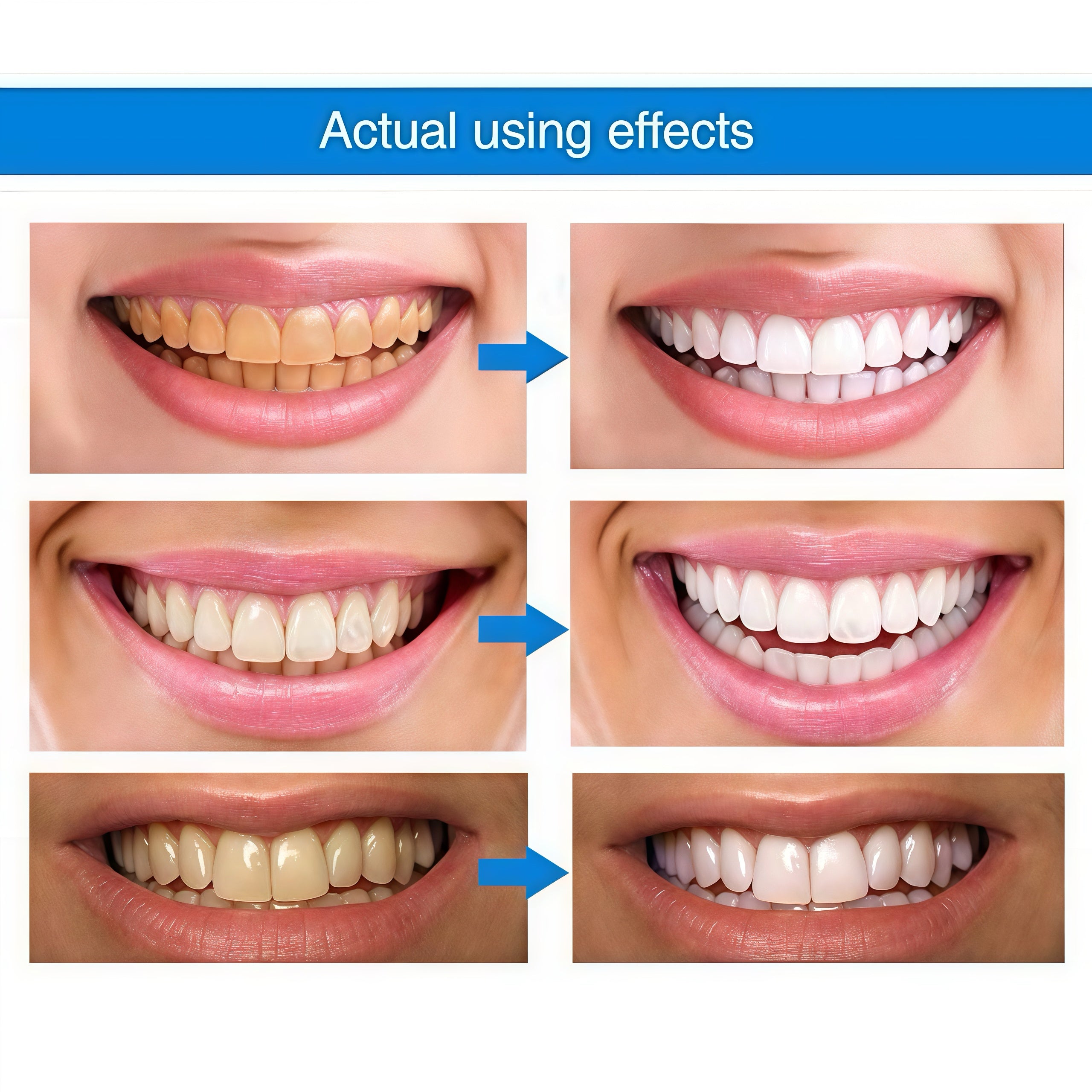 1+1 FREE l OralPlus™ Brighten your smile effortlessly