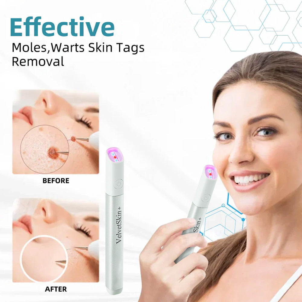 DermaBeam Pro – Erase Skin Flaws Instantly