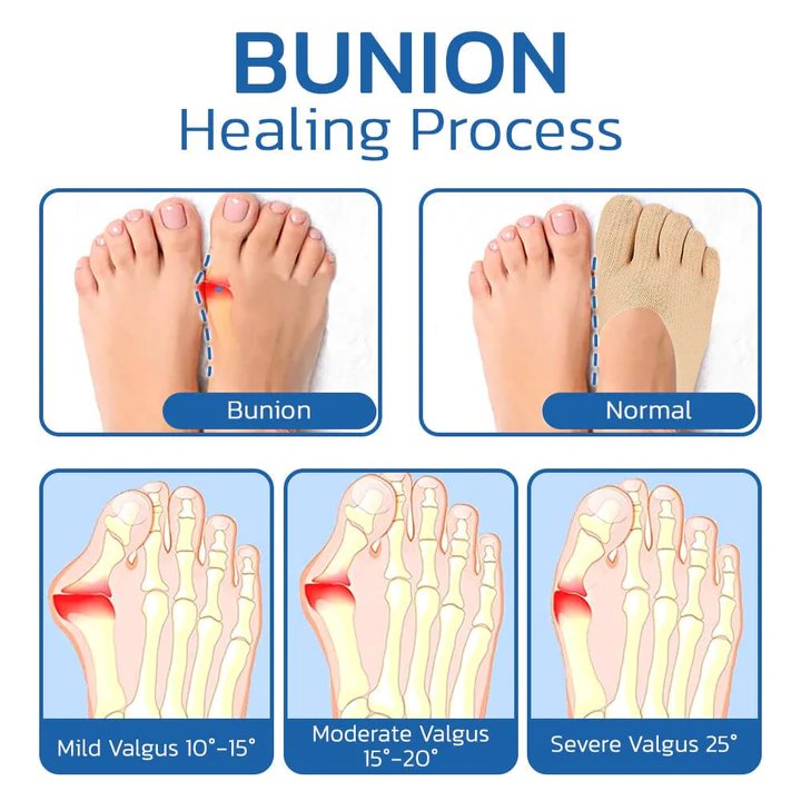 Orthopedic Support Socks - Bunion Relief Design for All-Day Comfort