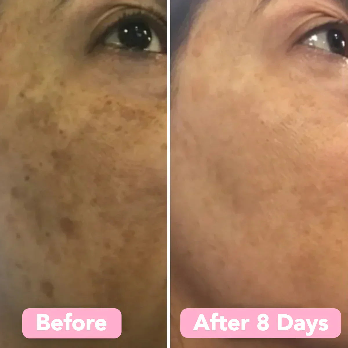 Caedrea Kojic™ Turmeric & Kojic Acid Pads | 40 Pack