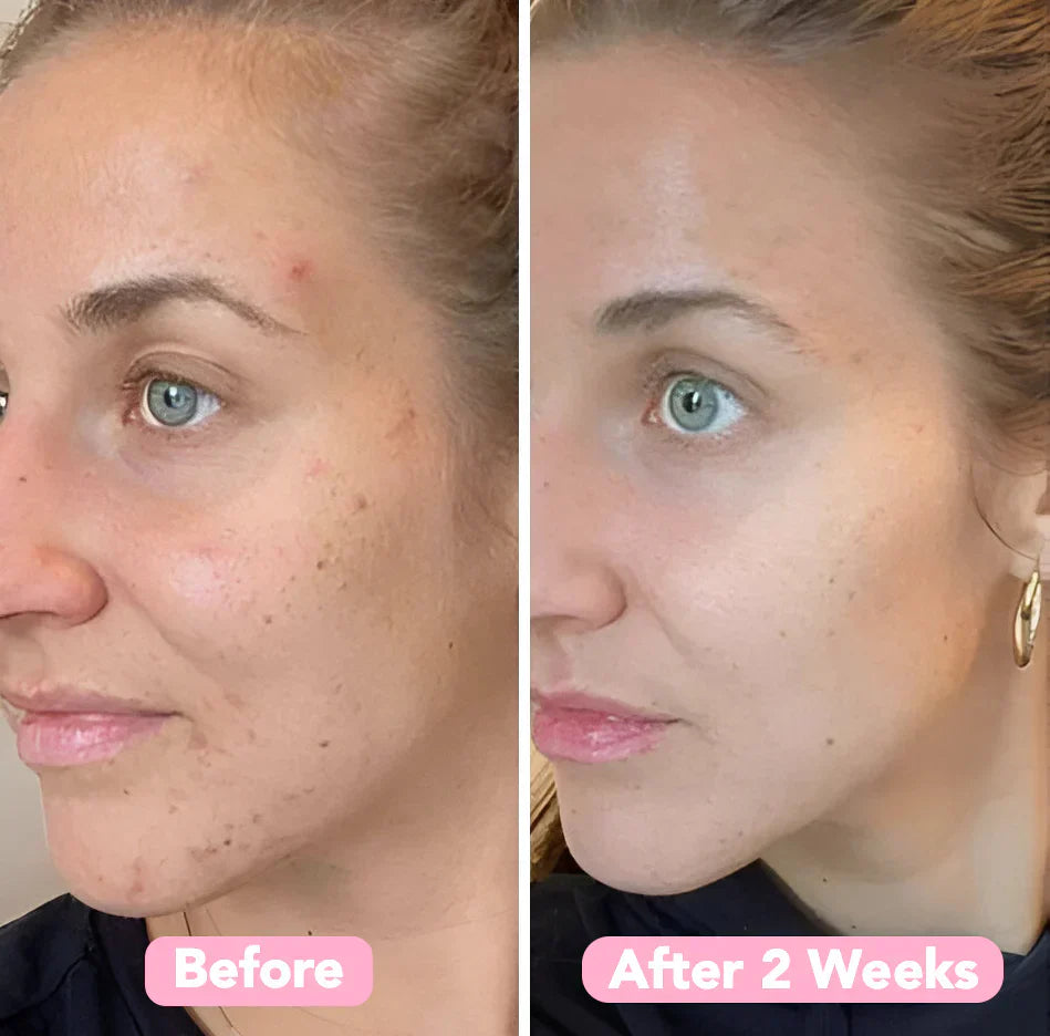 Caedrea Kojic™ Turmeric & Kojic Acid Pads | 40 Pack