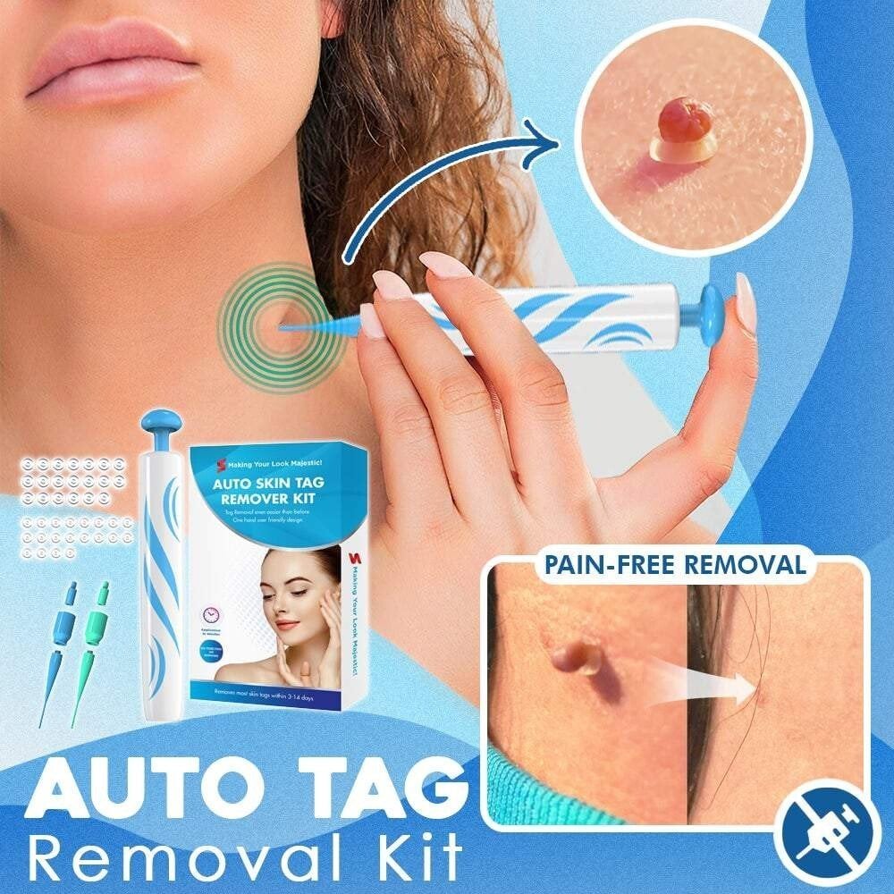DermaTag Removal Kit