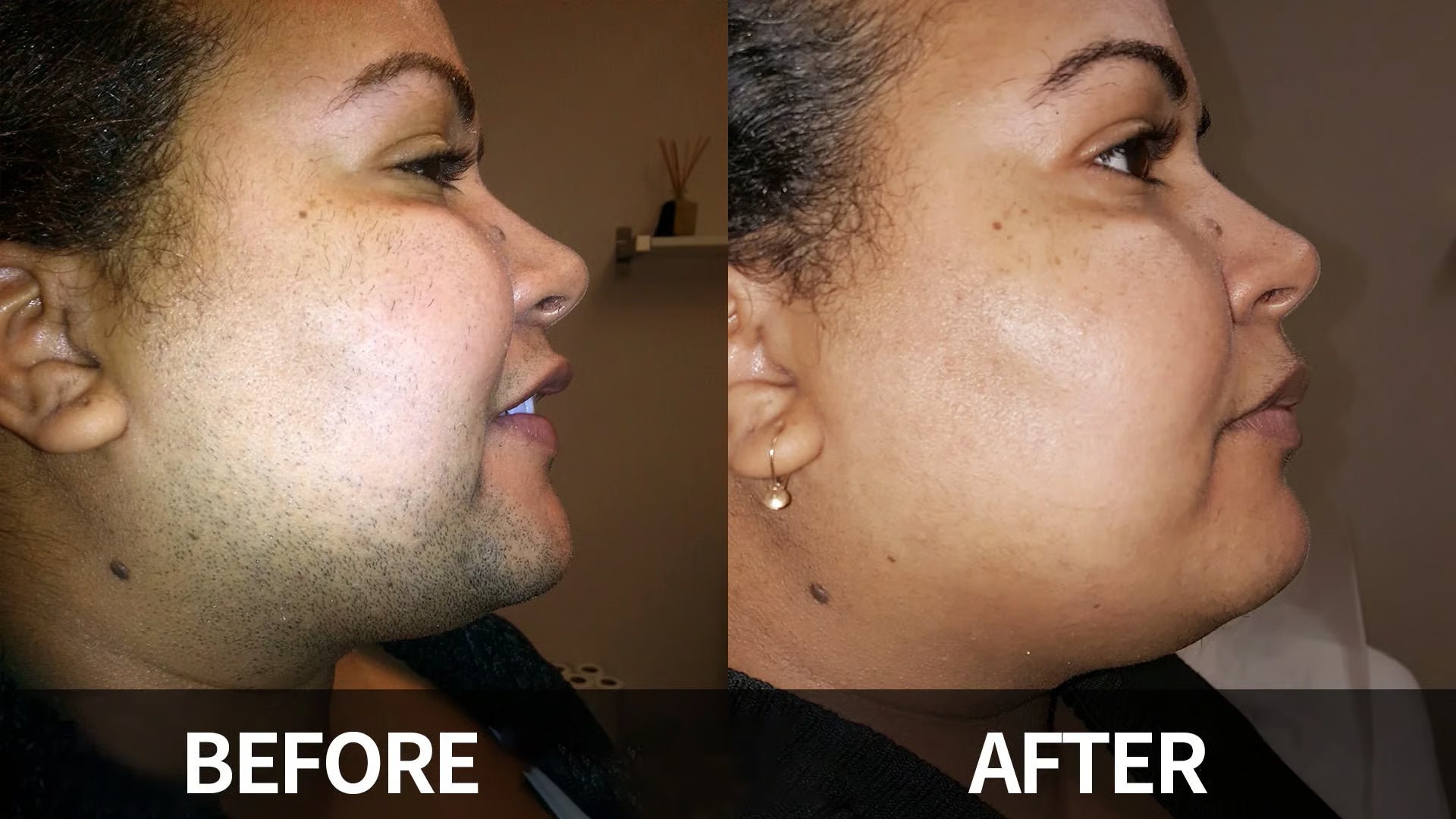 SilkyEase Precision Cream