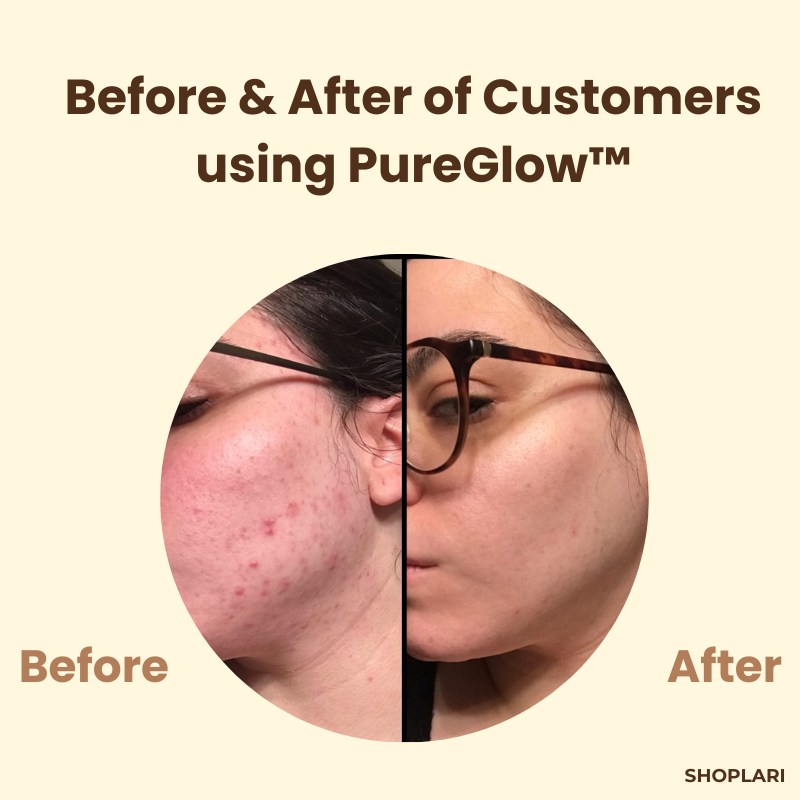 1 + 1 FREE | The PureGlow Black Tea Mask - A Total Skin Reset in a Jar
