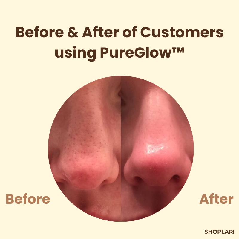 1 + 1 FREE | The PureGlow Black Tea Mask - A Total Skin Reset in a Jar