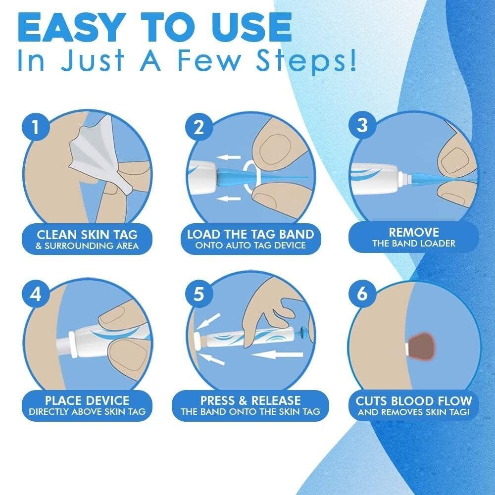 DermaTag Removal Kit