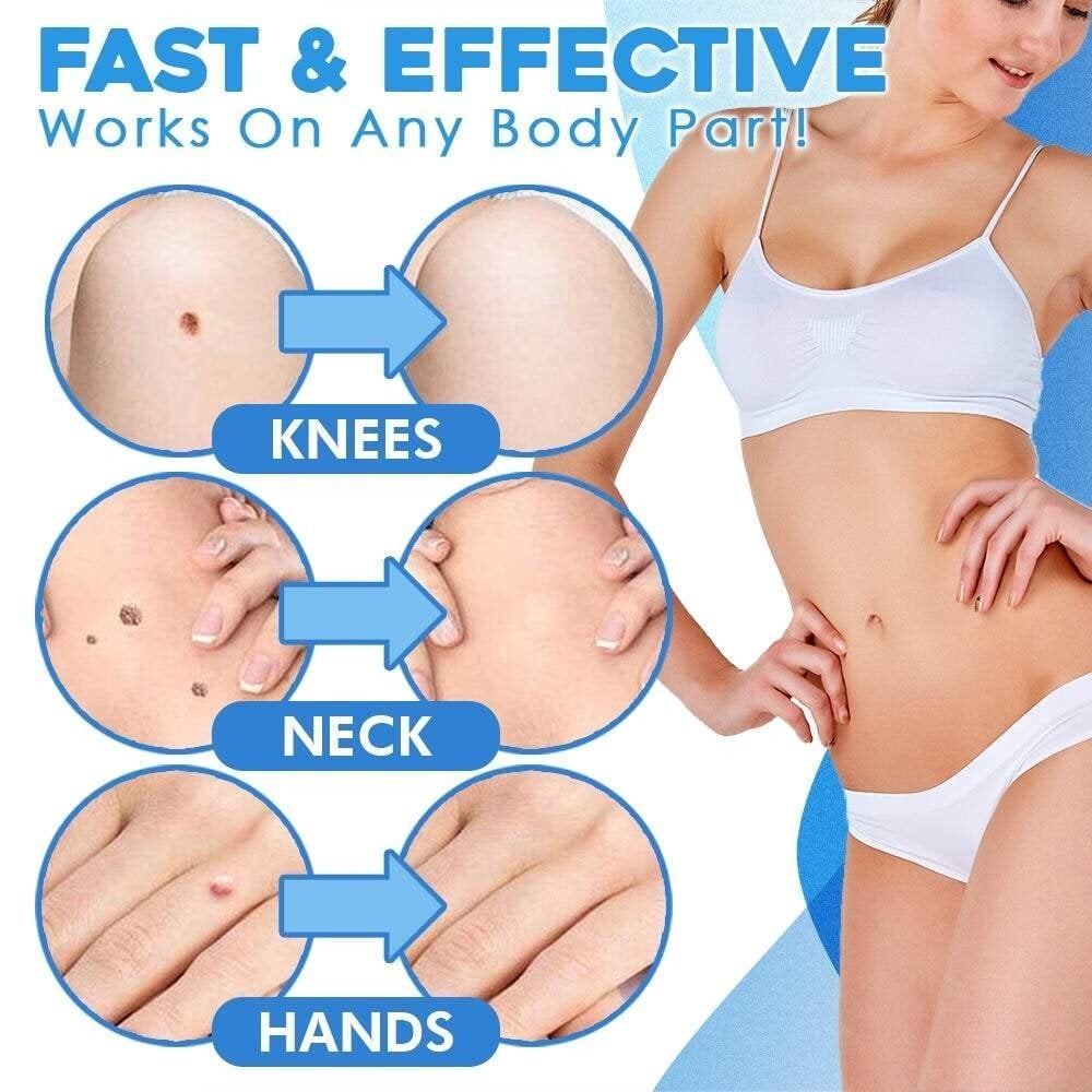 DermaTag Removal Kit