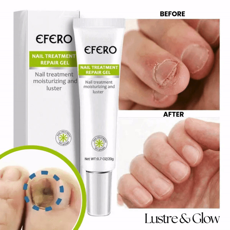 Evolvo™ Nail Repair Gel